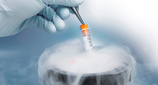 Cryogenic labels